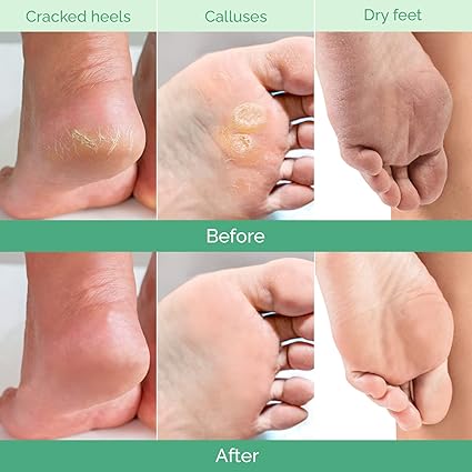 Soft & Smooth Feet Peel Mask